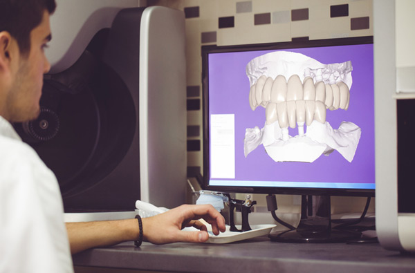 Man sitting at desk looking at a digital dental impression at North Hills Implant & Oral Surgery in Raleigh, NC